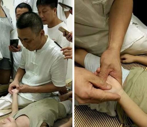 小兒推拿